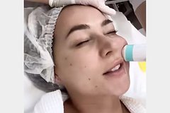 Blogersha lerchek pokazala video posle podtjazhki lica 9b0968b.jpg