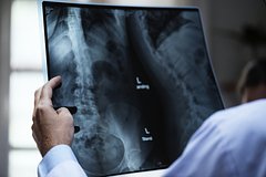 Nazvany glavnye simptomy pjati vidov zhenskogo raka 29f161a.jpg